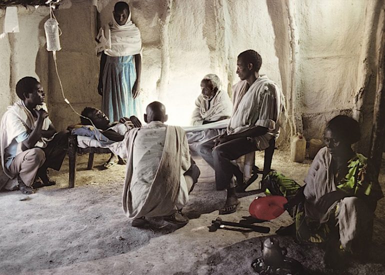 Ethiopie_Adebey_frontiere Soudan et Erythree_Clinique de brousse_Dans le cadre d'une campagne contre le paludisme_Anemie severe_plasmodium falciparum,soigne par quinine et chloroquinine1993