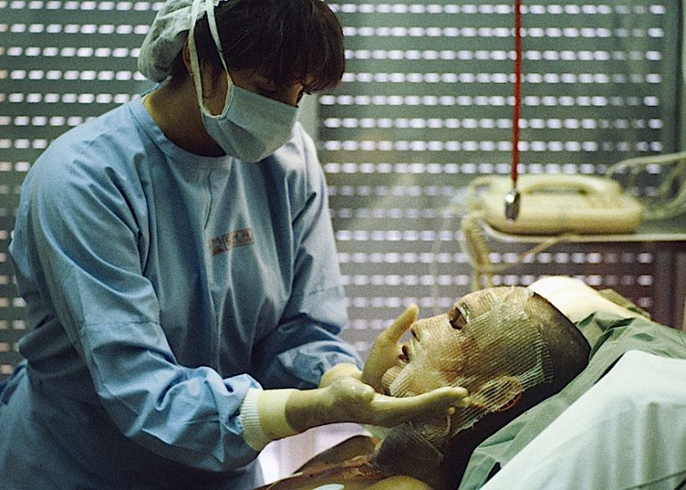 France_Hopital de Rangueil à Toulouse_département des grands brulés_1992