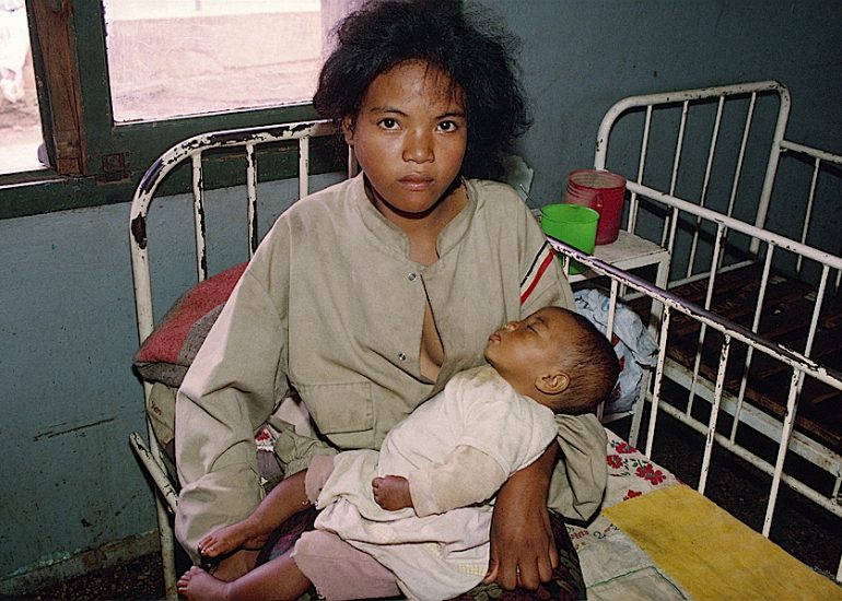 Madagascar_Antsirabe_Enfants des rues_Cette gamine de 14 ans est venu se refugier a l'hopital_au centre de renutrition intensif supervise par Medecins sans Frontieres_1999
