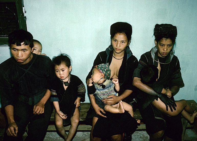 Viet-Nam_Province Lao-Cai_au nord d'Hanoi_frontiere Chinoise_Visite medicale pour la recherche du parasite du paludisme_1994