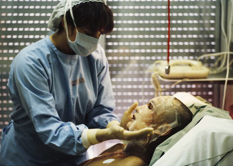 France_Toulouse_Hopital de Rangueil_Grands brules_1988